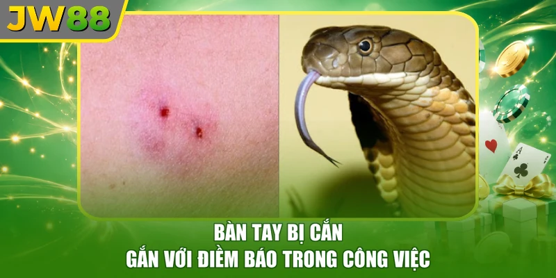 Bàn tay bị cắn gắn với điềm báo trong công việc